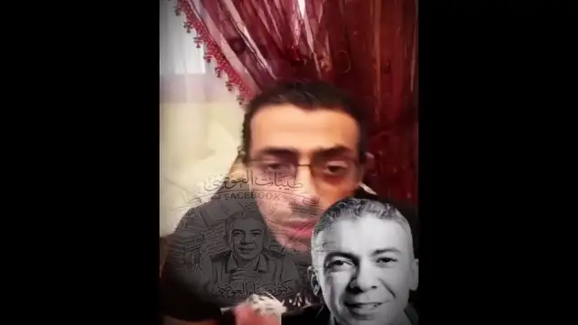 د ضياء العوضي حالة صدفية شديدة